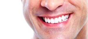 snowhite-teeth-whitening-france-ou-trouver-commander-site-officiel