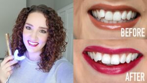 snowhite-teeth-whitening-prix-ou-acheter-en-pharmacie-sur-amazon-site-du-fabricant